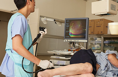 内視鏡検査（大腸カメラ）：イメージ